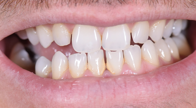 Philip Friel Advanced Dentistry - Before