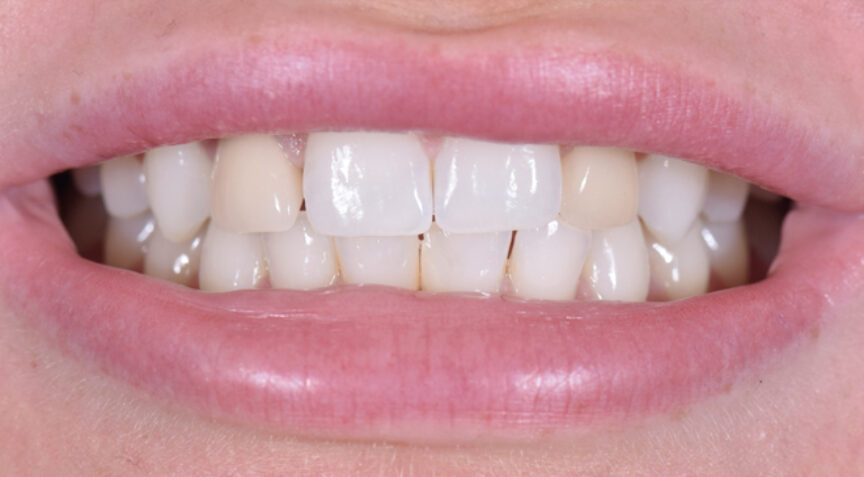 Philip Friel Advanced Dentistry - Before