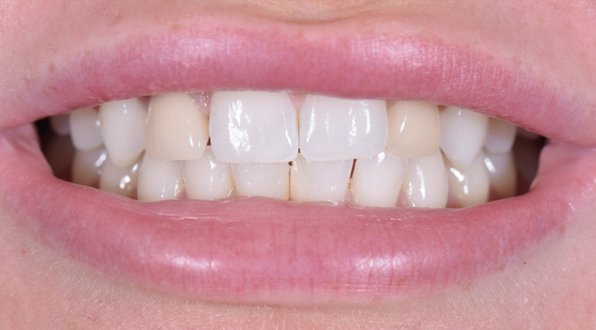 Philip Friel Advanced Dentistry - Before