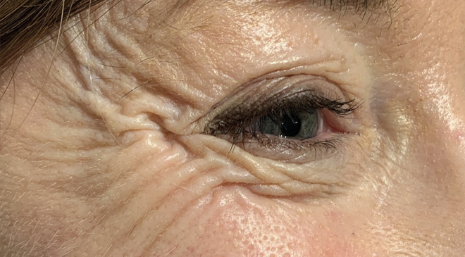 Philip Friel Advanced Dentistry - Before