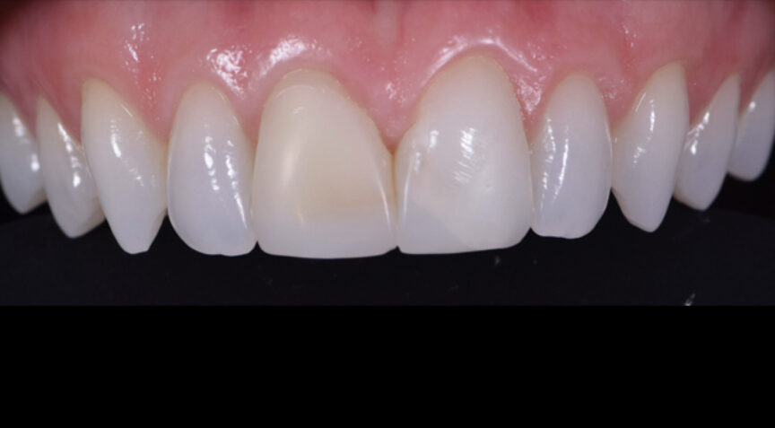 Philip Friel Advanced Dentistry - Before