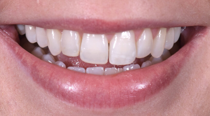 Philip Friel Advanced Dentistry - Before