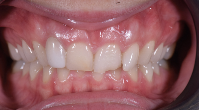 Philip Friel Advanced Dentistry - Before