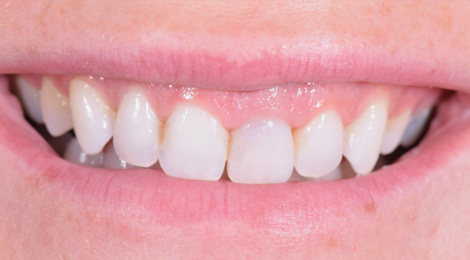 Philip Friel Advanced Dentistry - Before