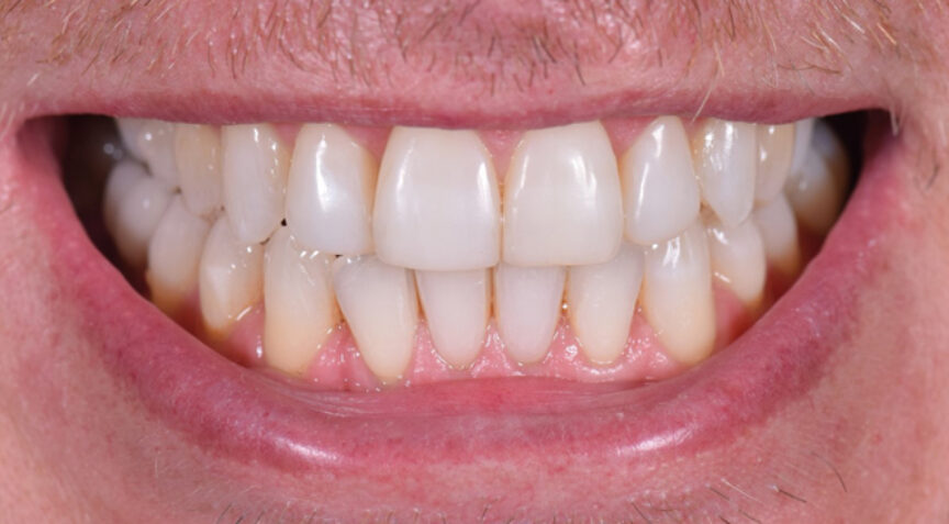 Philip Friel Advanced Dentistry - After