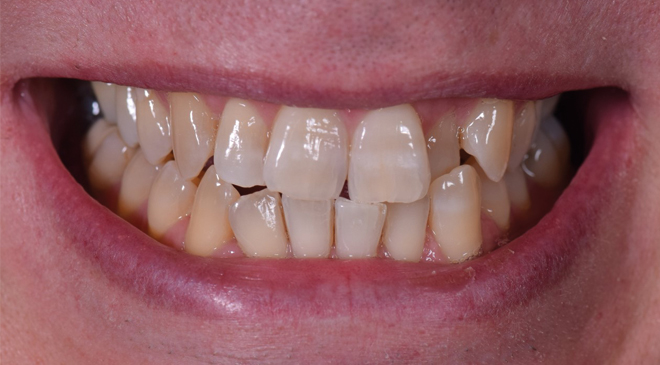 Philip Friel Advanced Dentistry - Before