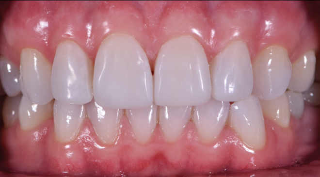 Philip Friel Advanced Dentistry - After