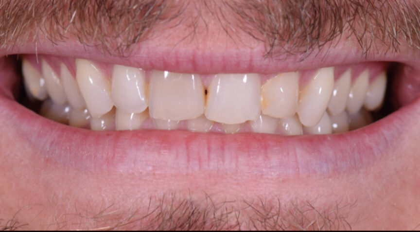 Philip Friel Advanced Dentistry - Before