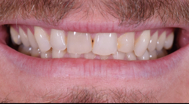 Philip Friel Advanced Dentistry - Before