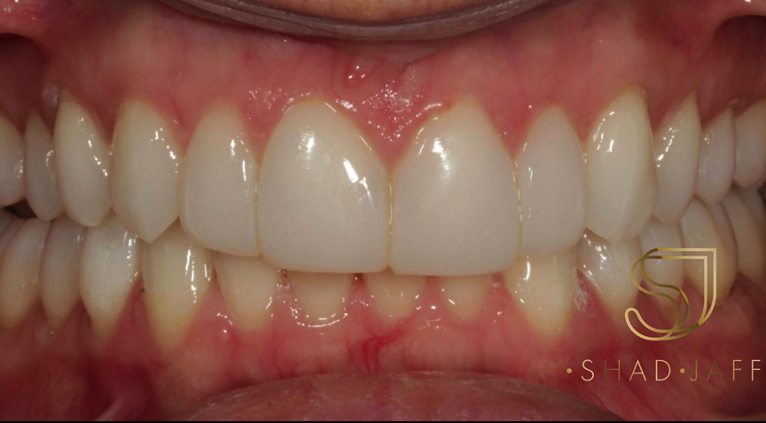 Philip Friel Advanced Dentistry - After