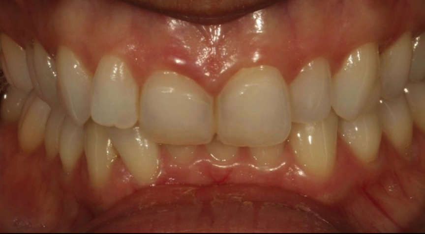 Philip Friel Advanced Dentistry - Before