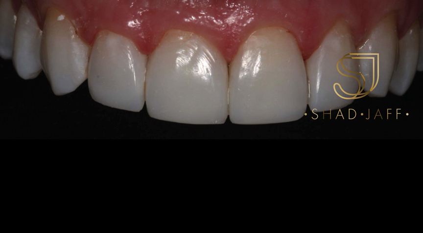 Philip Friel Advanced Dentistry - After
