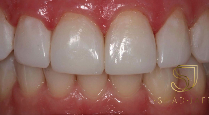 Philip Friel Advanced Dentistry - After