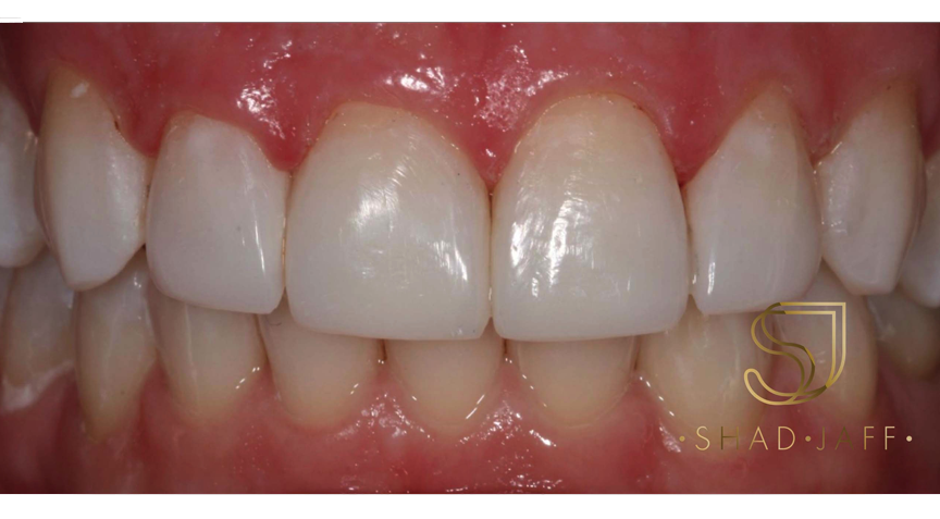 Philip Friel Advanced Dentistry - After