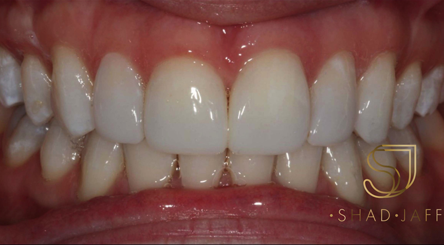 Philip Friel Advanced Dentistry - After