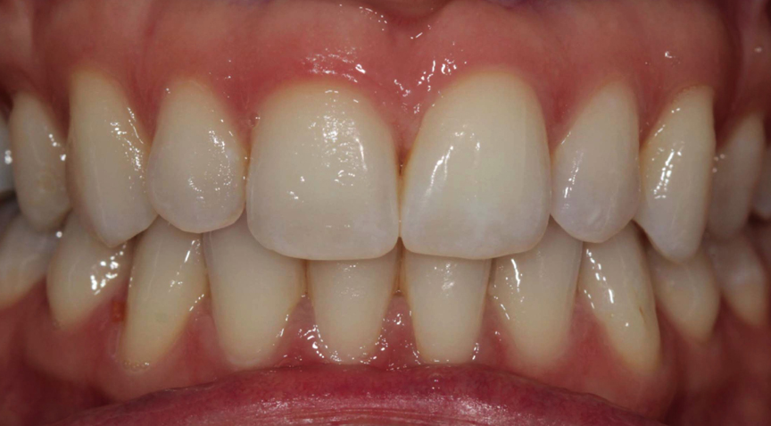 Philip Friel Advanced Dentistry - Before